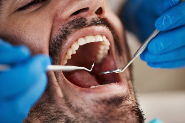 Best Emergency Dental Care for Abscessed Tooth in Morehead City, NC